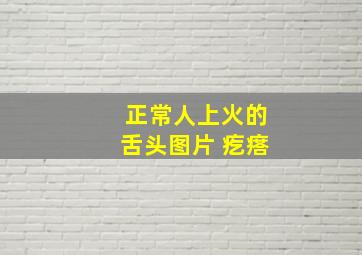 正常人上火的舌头图片 疙瘩